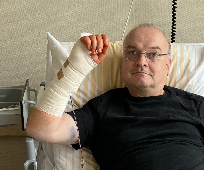 Cyborg1 Speichenbruch Radiusfraktur